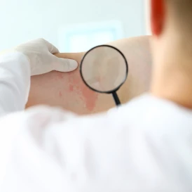 Dermatološki pregled